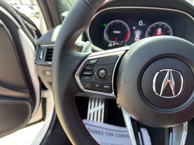 2025 Acura TLX Type S
